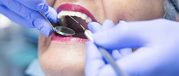 Best Emergency Root Canal Treatment in Vienna, IL